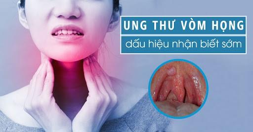 Tầm soát Ung thư vòm họng