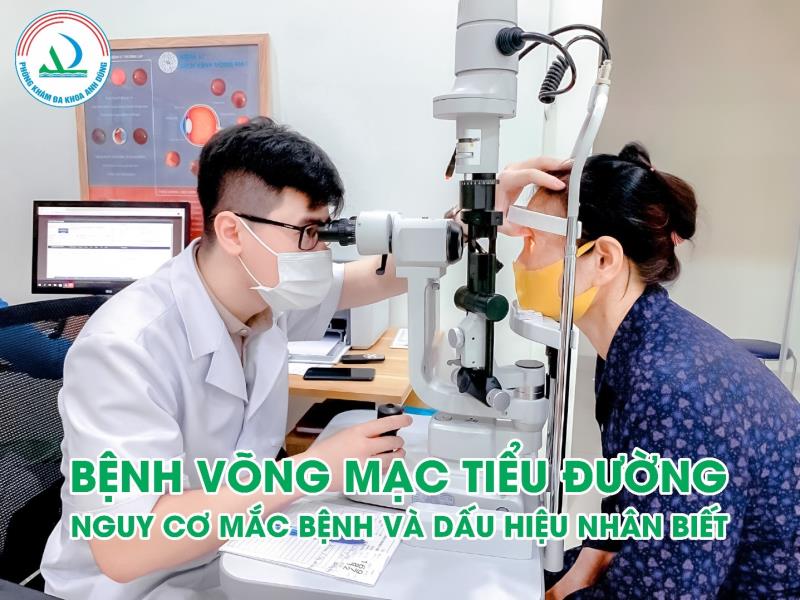 Bệnh võng mạc tiểu đường & những điều cần biết