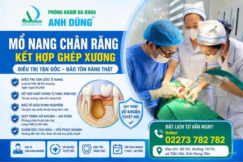 Mổ nang chân răng kết hợp ghép xương – Điều trị tận gốc, bảo tồn răng thật